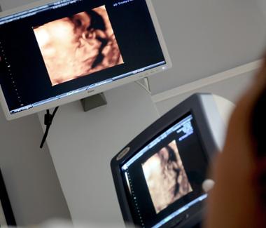 MBB'er specialisatie echografie (36 uur)